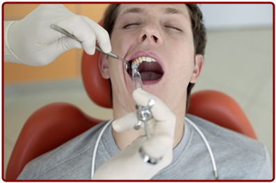 Wisdom Teeth Removal - Ogden Dentist